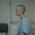 Symptoms of advanced stomach cancer