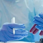 1-Hour Glucose Tolerance Test